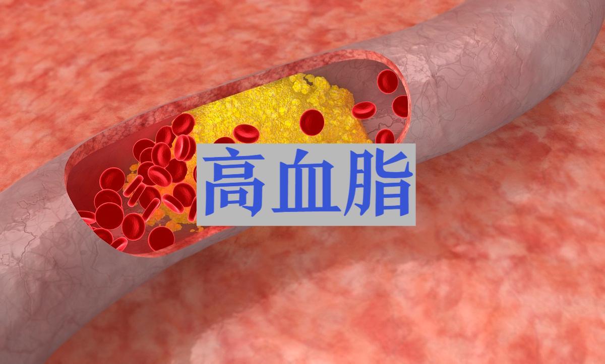 皮蛋再次成为关注对象!研究发现:高血脂吃皮蛋,身体或有6改善